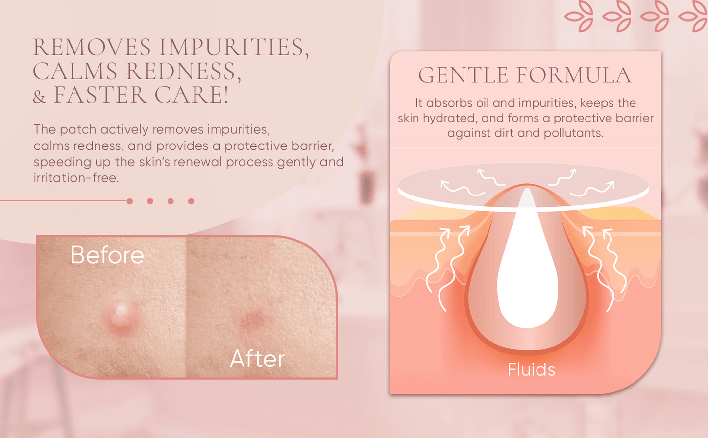 Prime Patch - Hydrocolloid Pimple Patches for Face