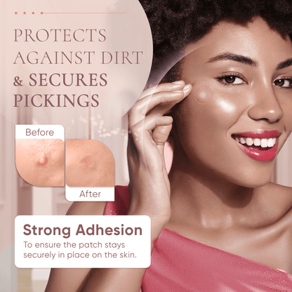 Prime Patch-Hydrocolloid Pimple Patches for Face